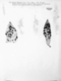 Mycosphaerella asteroma image